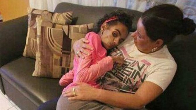 Young Woman Left Brain Damaged After Doing Something Girls In America Do Every Single Day
