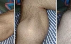 This Is The Reason You Have Leg Cramps During The Night - Prevent Them By Doing This!
