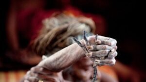 This Man Has Been Holding His Hand In The Air Since 1973; Here Are His Fingers Now (Photos)