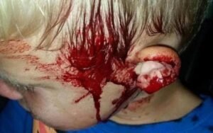 Son’s Scream Wakes Mother, She's Shocked At What She Sees Hanging Off His Face