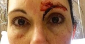 Rapist Attacks Jogger, Gets Horrible Surprise As He Tries To Rip Her Shorts Off