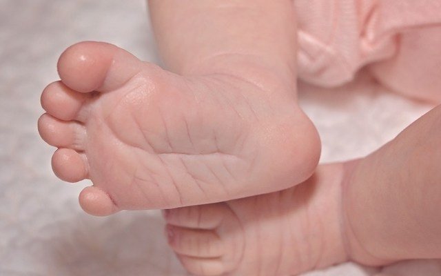 Malnourished Baby Dies Due To Parents' Strict Diet
