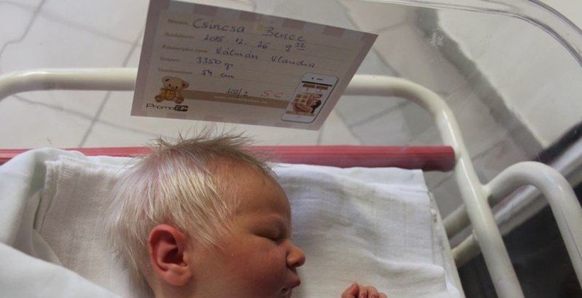 Baby Born With Grey Hair Leaves Parents Concerned