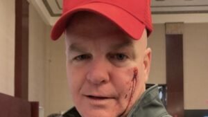Woman Punches Retired NYPD Detective Because Of His Birthday Hat