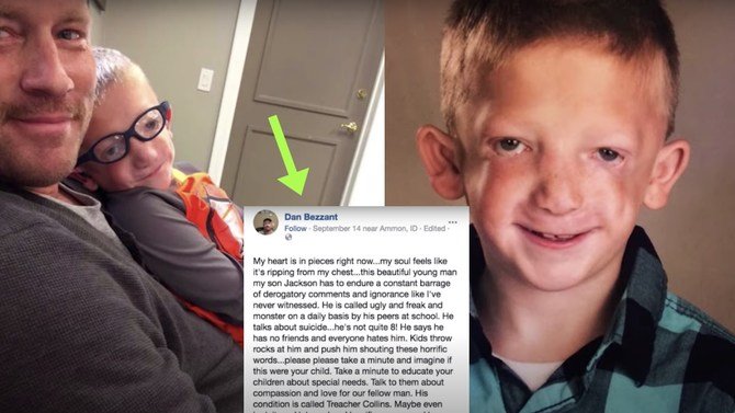 Dad Speaks Out, Sends Message To Bullies After His Son Is Called 'Monster' At School