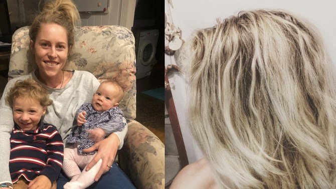 Mom Shares Her Experience After Not Washing Her Hair For 8 Months